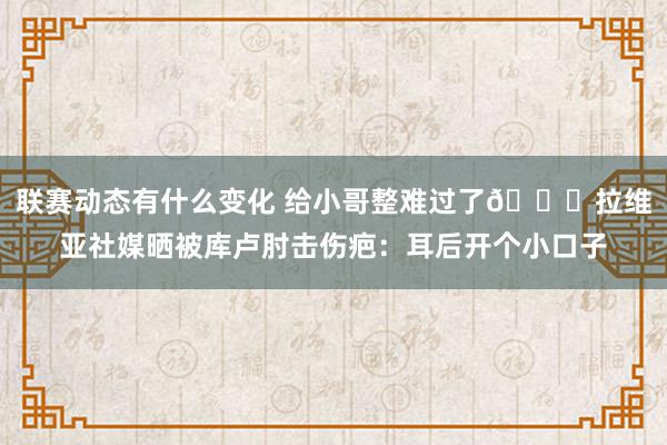 联赛动态有什么变化 给小哥整难过了😅拉维亚社媒晒被库卢肘击伤疤：耳后开个小口子